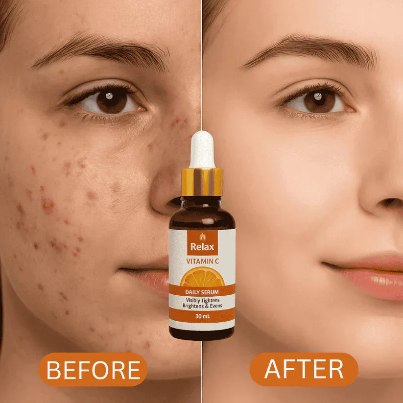 RELAX | FACE SERUM  (VITAMIN C)