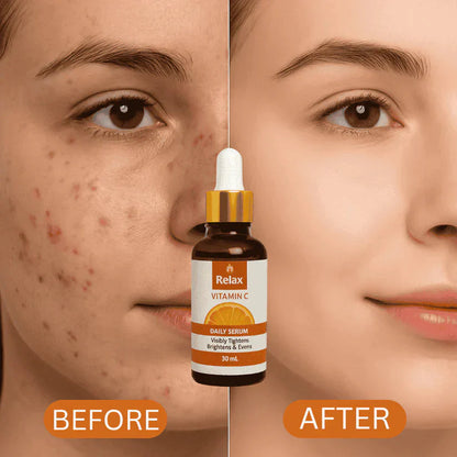 RELAX | FACE SERUM  (VITAMIN C)