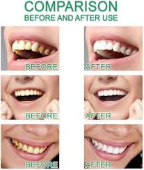 Nicotinamide Toothpastes, Remove Tooth Stains, Fresh Breath
